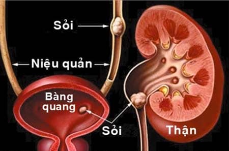 Nước cứng và tác hại của nước cứng